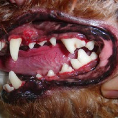 歯周病（中期）