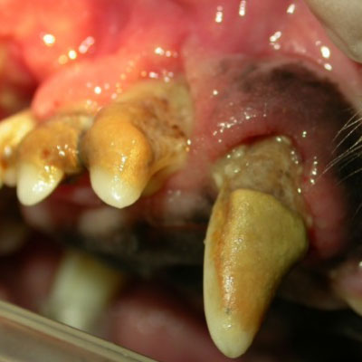 歯周病（末期）